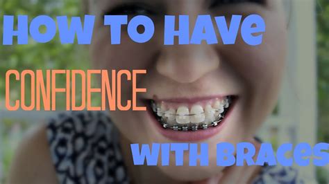 How To Have Confidence As An Adult With Braces Youtube