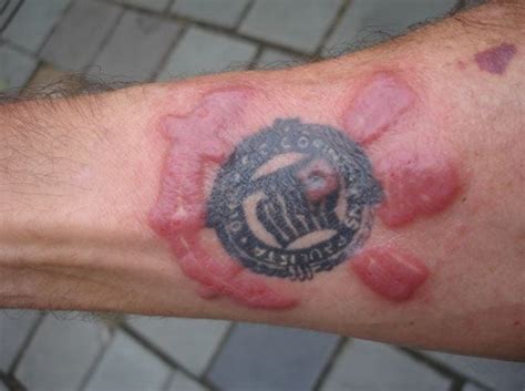 Second Skin Tattoo Healing Process | Togo List