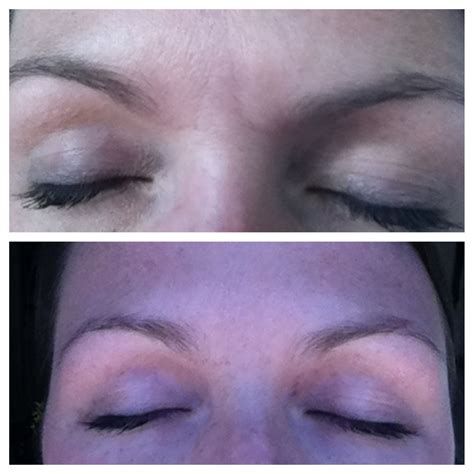 My Nerium Ad Results Smaller Pores Better Texture And No More Mad