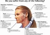 Bad Migraine Treatment Images