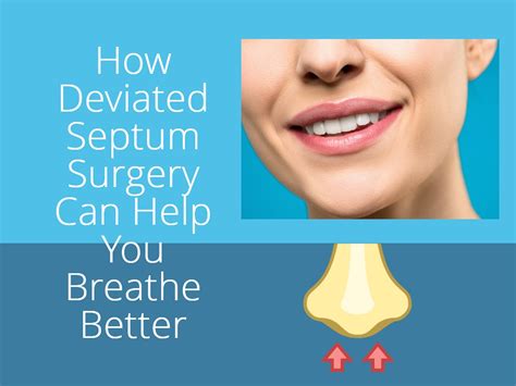 What Is The Cost Of Deviated Septum Surgery With Insurance March 2024