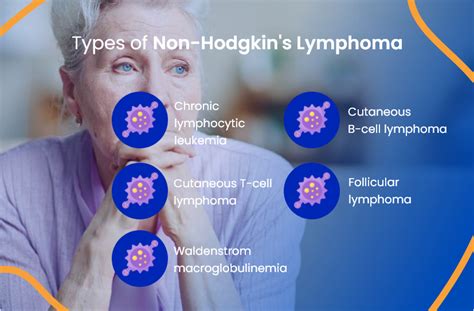Non Hodgkin Lymphoma Everything You Need To Know Actc