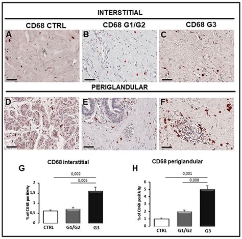 Bcl6/p53 expression, macrophages/mast cells infiltration and