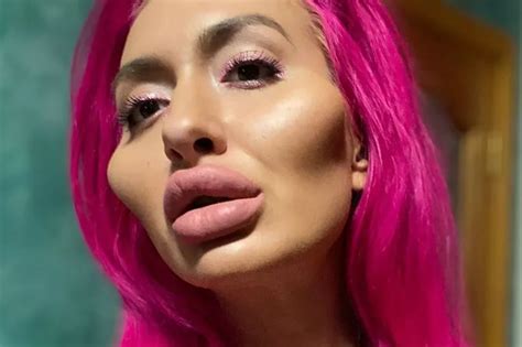 Extreme Body Model Addicted To Cheek Filler Injects Her Own Face To Look Weird Daily Star
