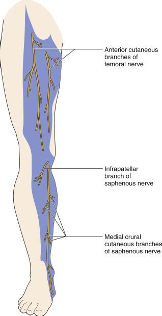 Femoral Pain Syndrome
