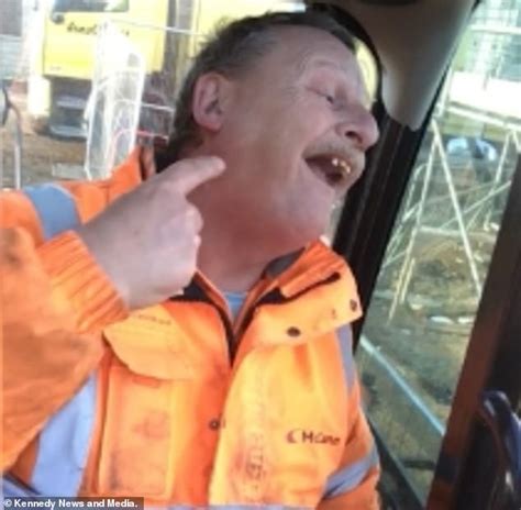 Builder 58 Gets Workmates To Pull Out His Teeth With Pliers Daily