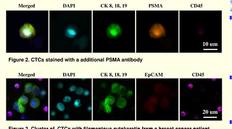 Figure 2 From Identifying And Subtyping Circulating Tumor Cells Ctcs