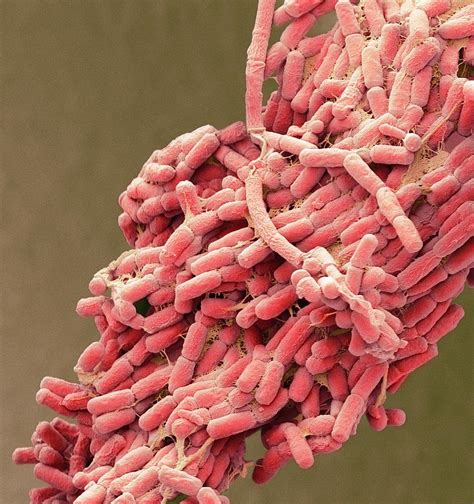 E Coli Bacteria Photograph By Steve Gschmeissner Pixels