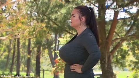 Woman With 34k Boobs That Wont Stop Growing Asks Strangers To Pay