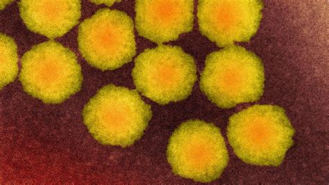 Rare Polio Like Disease Reports Bbc News