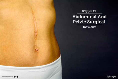 8 Types Of Abdominal And Pelvic Surgical Incisions By Dr Ajay Gupta