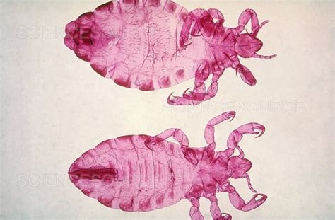 Body Louse Leg LM Stock Image Science Source Images