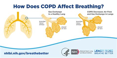 How Does Copd Affect Breathing Chronic Obstructive Pulmon Flickr