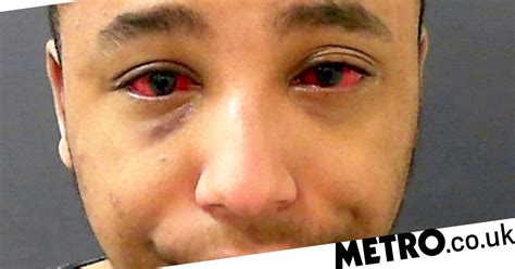 Sex Attacker Told Women Look Into My Eyes Im Going To Kill You In