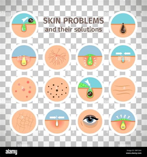 Skin Problems Facial Treatments Face Washing And Problem Correction