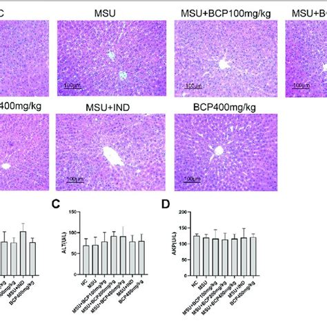 Liver Histology And Serum Markers Of Liver Damage A H And E