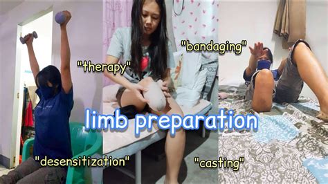 Prosthetics Limb Preparation Cherry Ramos Youtube