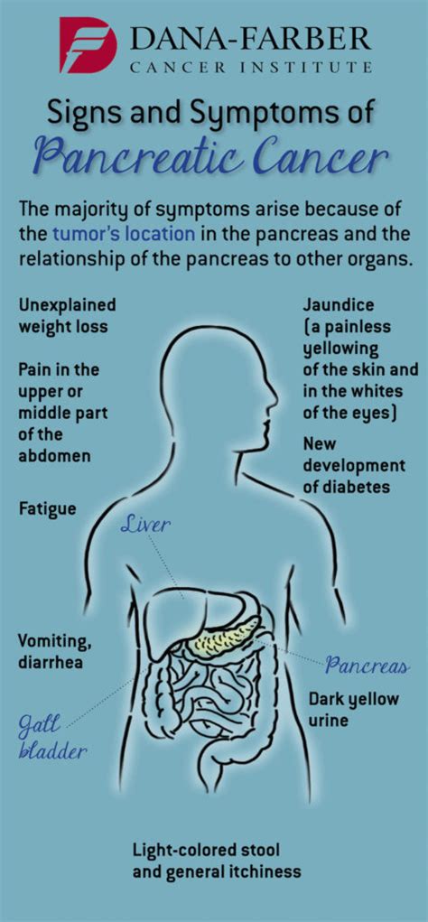 Pancreatic Cancer What Are The Signs And Symptoms Dana Farber