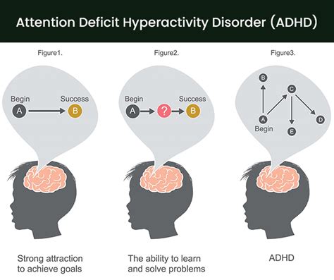 Online Adhd Treatment Professional Community Article By Online