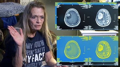 Brain Tumor Only Discovered After Woman Goes To Hospital For Crash