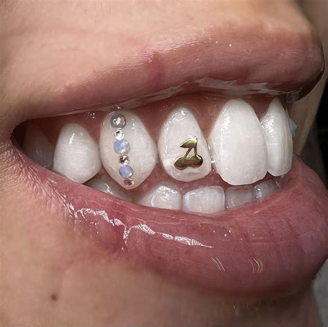 Teeth Gems Tooth Gems Teeth Jewelry Tooth Gem Aesthetic Tooth Gem