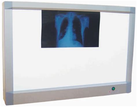 We did not find results for: X Ray Viewer,Xray Viewer,X-ray Led Film Viewer - Buy X Ray Viewer,Xray Viewer,X-ray Led Film ...