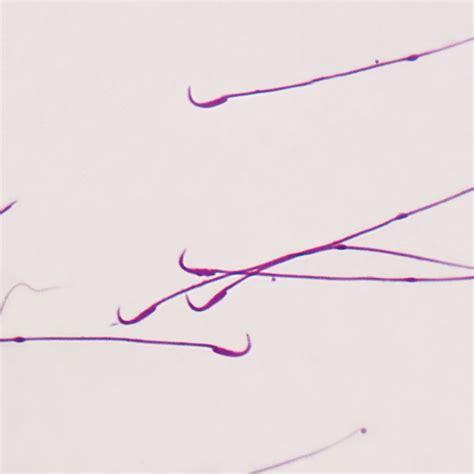 Mammal Rat Sperm Smear Microscope Slide