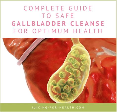 Gallbladder Cleanse Complete Guide To Safe Gallbladder Flush