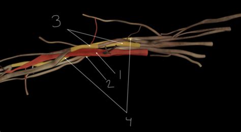 Injuries Of The Brachial Plexus Flashcards Quizlet