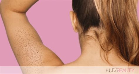 What Those Weird Itchy Arm Bumps Are And How To Get Rid Of Them Skin