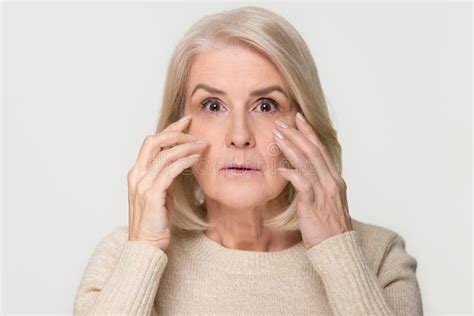 Woman Wrinkles Face Before After Treatment Difference Sagging