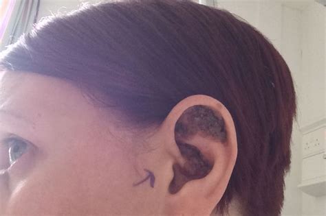 Ear Cancer Lump Cancerwalls