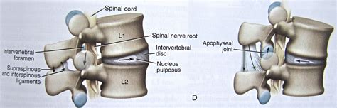 Figure 3 From Lumbar Degenerative Disease Part 1 Anat