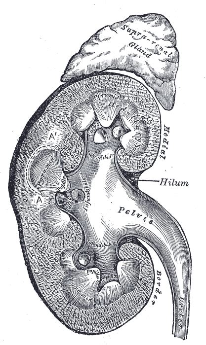 History And Case Studies Liddle Syndrome Resources