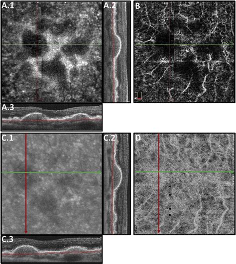 The Effects Of Imaging Wavelength On Image Penetration And Attenuation