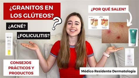 ¿granitos En Los GlÚteos ¿foliculitis AcnÉ Granos ¿por QuÉ Salen