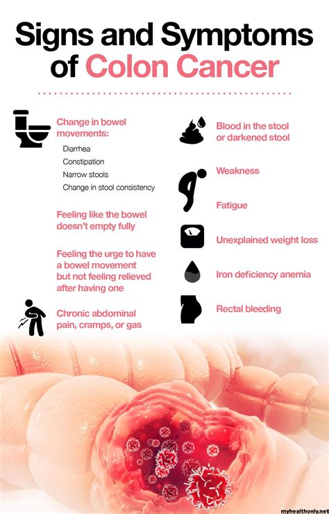 Symptoms of Colon Cancer, Risk Factors and Causes - My Health Only