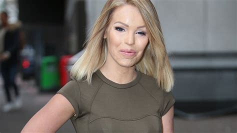 Katie Piper Shares Graphic Post Acid Attack Photos ‘im Proud To Be A Survivor Closer