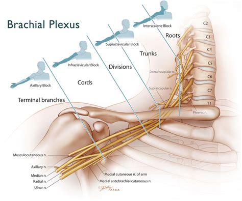 Idealized Brachial Plexus Various Approaches Define Individual