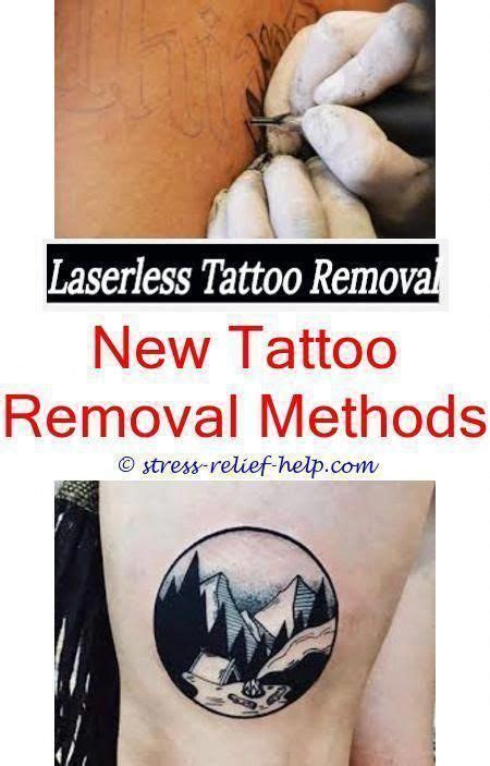 And costs less than half an xbox one. Diy tattoo removal methods.Salabrasion tattoo removal before and after.How much is laser tattoo ...
