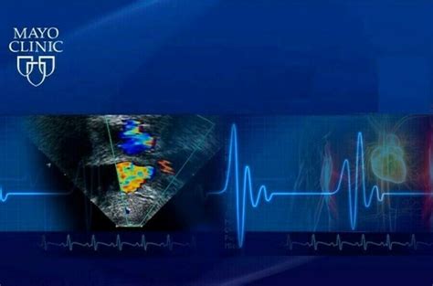 Mayo Clinic Echocardiography Board Review 2018