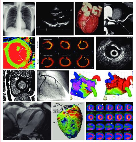 Different Modalities Of Cardiovascular Imaging Download Scientific