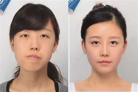 Crazy Before And After Photos Of South Korean Plastic Surgery Page 2
