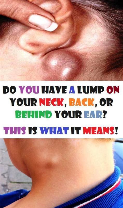Do You Have A Lump In Your Neck Back Or Behind Your Ear This Really
