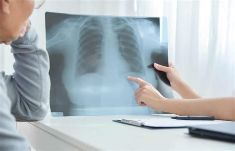 Are Your Symptoms Caused By Asbestosis L Lung Disease