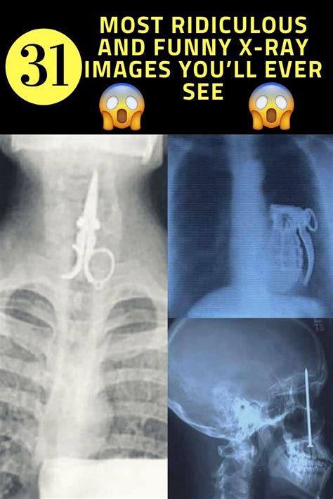 Her Are The 31 Most Ridiculous And Funny X Ray Images Youll Ever See