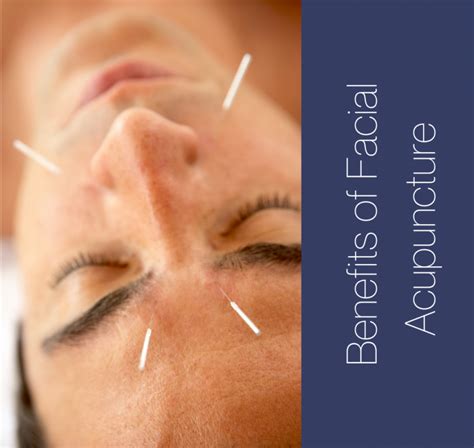 Rejuvenating Acupuncture And Gua Sha Facials In Gilbert Az