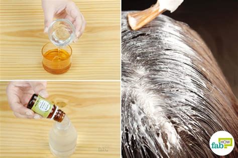 8 Best Home Remedies For Dry Flaky Scalp That Work Fab How