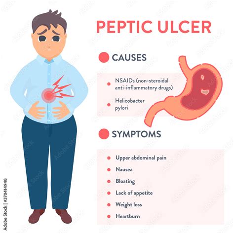 Peptic Ulcer Stomach Disease Infographic Poster Endos Vrogue Co
