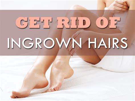 Remove individual ingrown hairs if you can see them easily beneath the surface of your skin. How to Get Rid of Ingrown Hairs